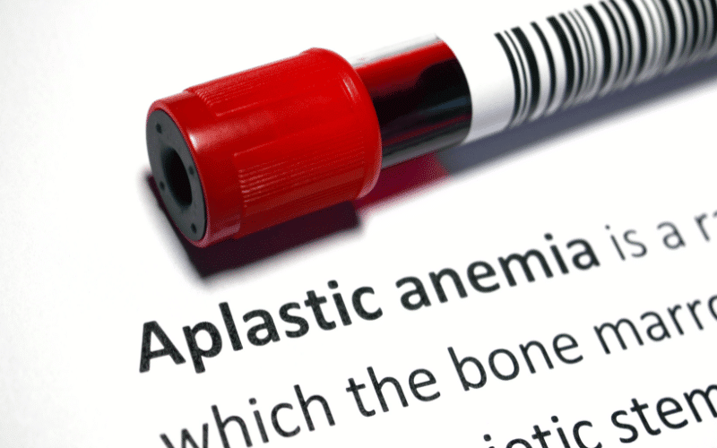 Aplastic Anemia A Rare But Serious Condition