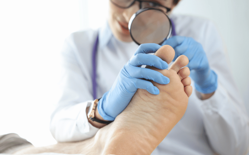 Athlete's Foot A Common Fungal Infection