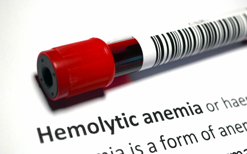 Autoimmune Hemolytic Anemia (AIHA)