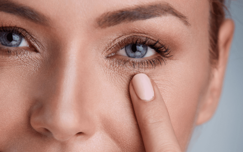 Eyelid Dermatitis Eczema Around the Eyes