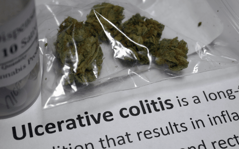 FAQs on Fighting Fatigue from Ulcerative Colitis