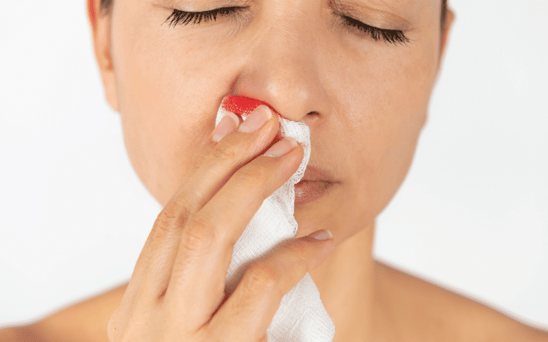 Frequent Nosebleeds and Nasal Congestion