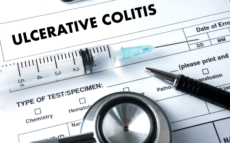 Frequently Asked Questions About Caring for Someone with Ulcerative Colitis