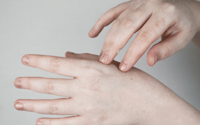 Frequently Asked Questions About Common Skin Conditions