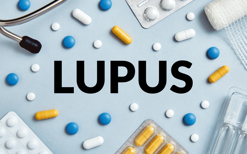 Frequently Asked Questions about Lupus and Its Symptoms