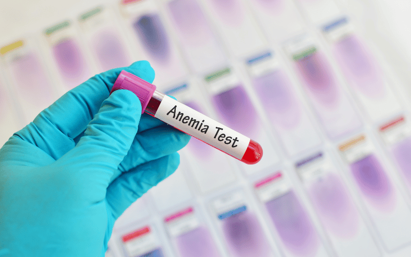 Frequently Asked Questions about Macrocytic Anemia