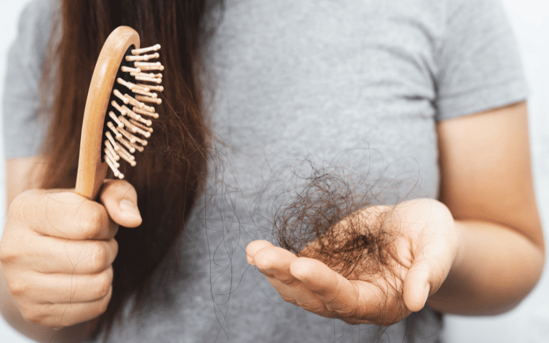 Hair Loss A Silent Consequence of Discoid Lupus