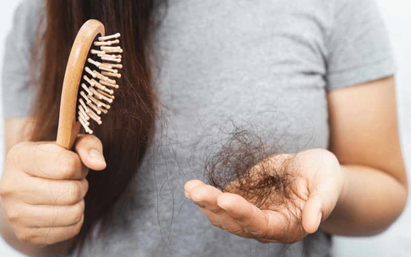 Hair Loss An Unexpected Consequence of Scalp Ringworm