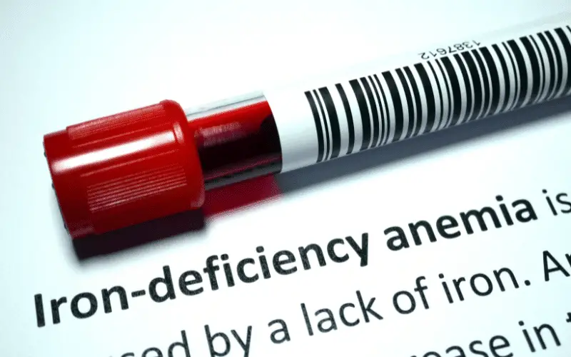 Iron-Deficiency Anemia Tackling the Most Common Form
