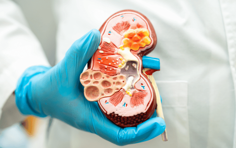 Kidney Disease The Role of Erythropoietin