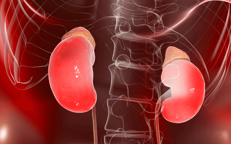 Kidney and Urinary Tract Abnormalities An Associated Feature of Fanconi Anemia