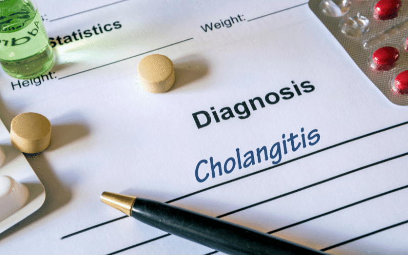 Primary Sclerosing Cholangitis A Rare Liver Disease