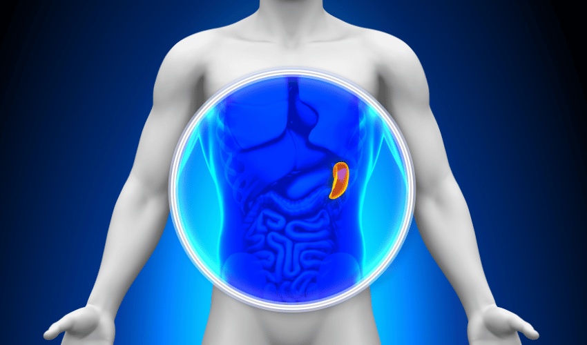 Symptom 10. Sideroblastic Anemia: Enlarged Spleen