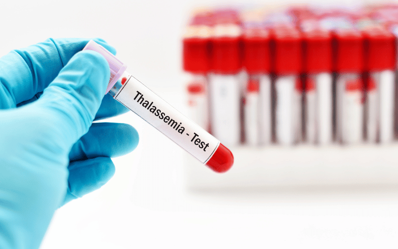 Thalassemia A Group of Inherited Blood Disorders