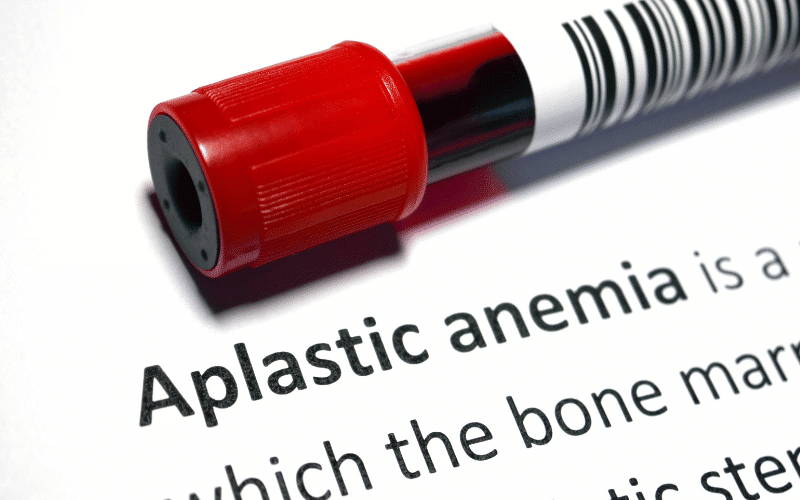 Top 10 Causes of Aplastic Anemia Unveiling the Mysteries Behind this