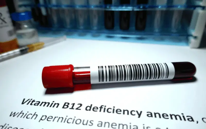 Vitamin B12 Deficiency Anemia The Importance of Essential Nutrients