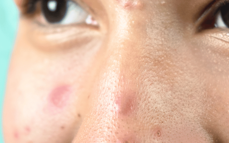 Unusual Lumps or Bumps When the Skin Speaks