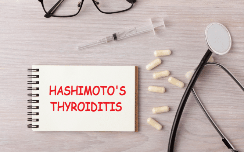 Discovering Hashimoto's Thyroiditis Unveiling the Top Ten Symptoms