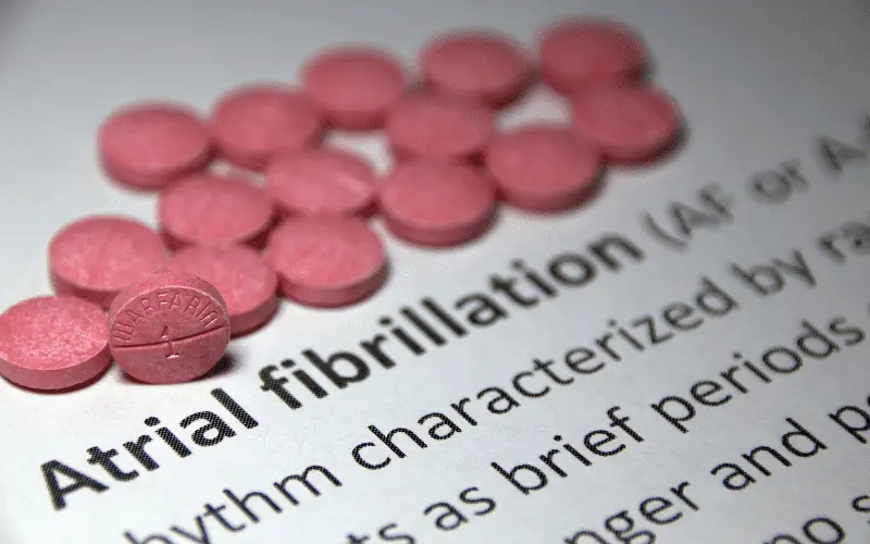A Deep Dive into Atrial Fibrillation Unmasking 13 Symptoms in Women