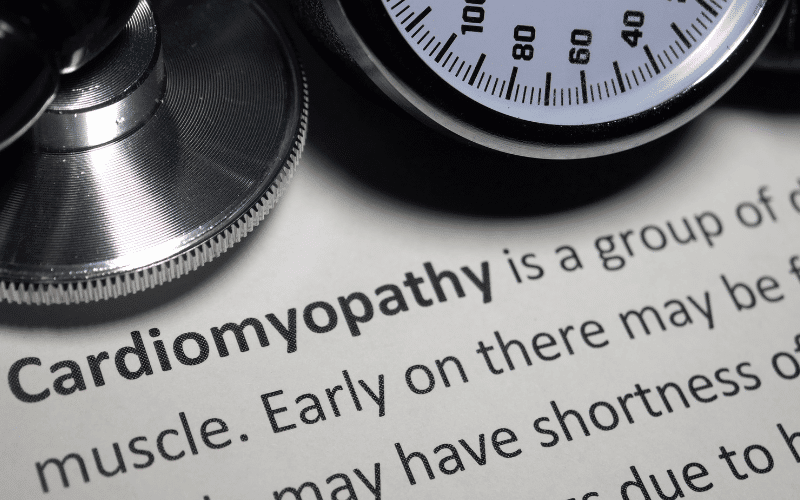 Empower Yourself 13 Facts About Cardiomyopathy for Health Conscious Individuals