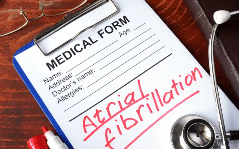 Identifying the Early Warning Signs 10 Symptoms of Atrial Fibrillation (AFIB) in Men