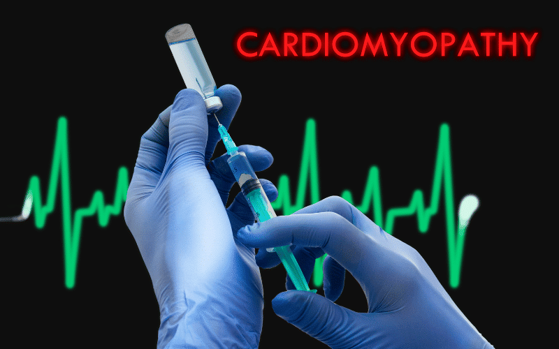 Understanding Cardiomyopathy The Top 10 Causes