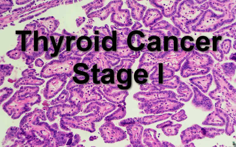 The Initial Trepidation Stage I Thyroid Cancer