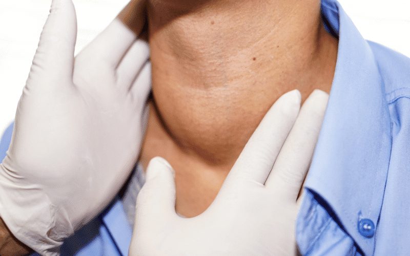 The Stealthy Growth - Rapid Enlargement of the Thyroid Gland