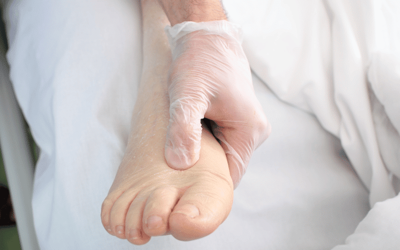 Swelling in Your Legs, Ankles, and Feet (Edema) - The Tell-Tale Tidal Waves