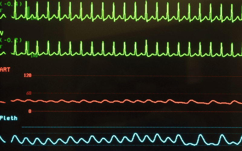 Racing Pulse A Heart in Overdrive