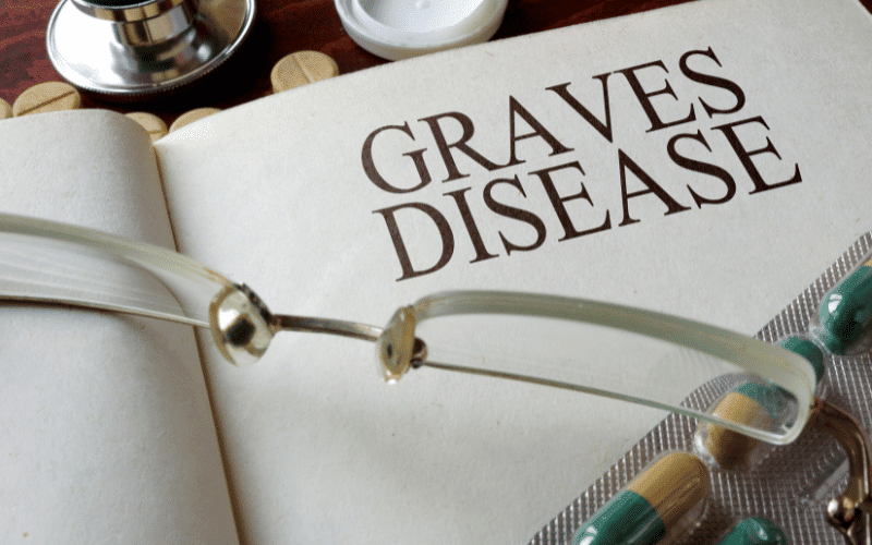 The Peril of Ignored Hyperthyroidism Stepping Stone to Graves' Disease