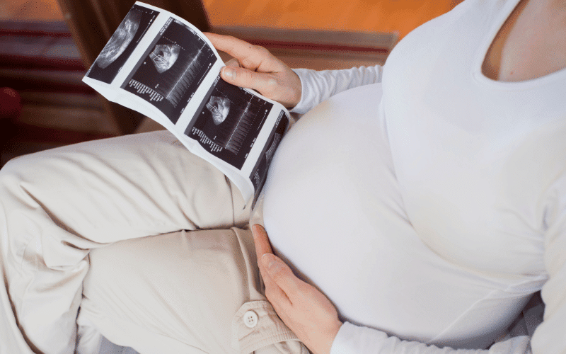 Pregnancy Complications Cardiomyopathy in the Wake of Motherhood