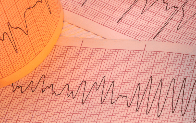 Rapid or Irregular Heartbeat When the Heart Marches to a Different Beat