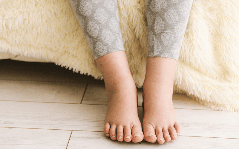 Swelling in the Ankles, Legs, and Feet – The Fluid Footprints