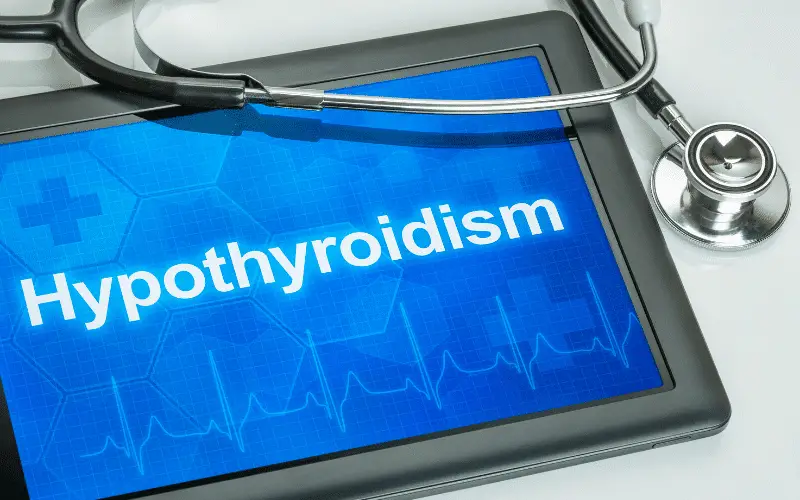 Hypothyroidism The Unseen Thief of Vitality