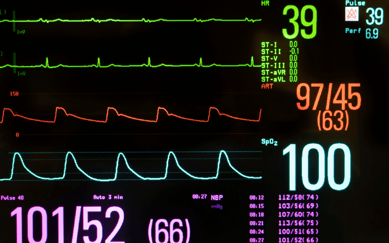 Changes in Heart Rate The Unpredictable Pulse