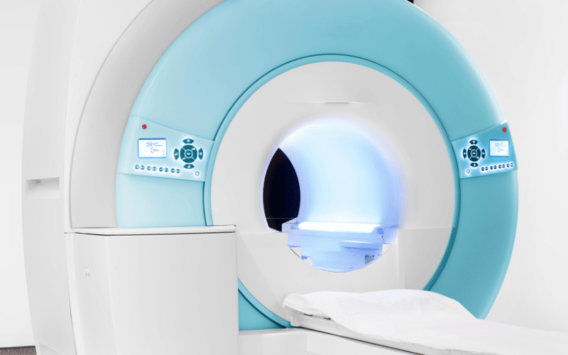 The MRI Reveal Imaging Insights into Chronic SVD