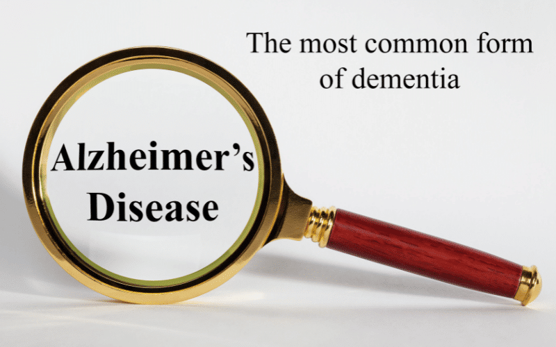 MCI and Alzheimer’s Disease A Possible Precursor