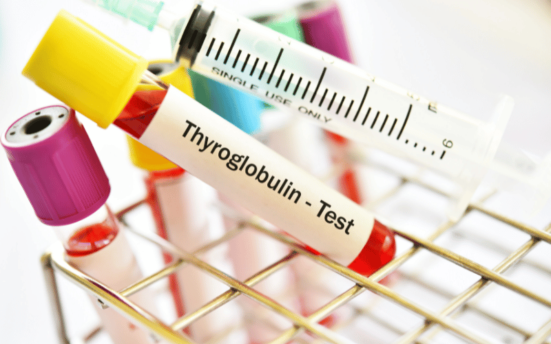 Thyroglobulin Testing The Vigilant Watchdog