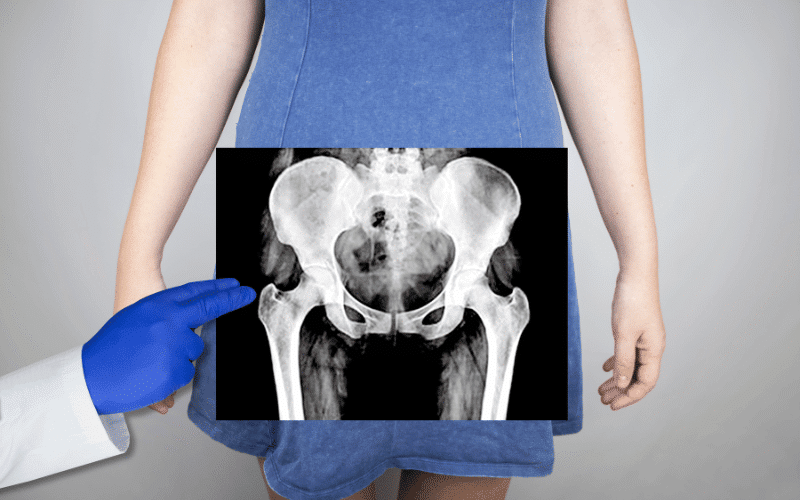 Pelvic Mass – The Stealthy Intruder