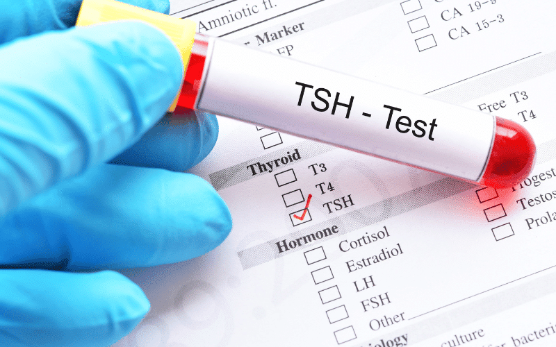 Thyroid-Stimulating Hormone (TSH) The Silent Regulator