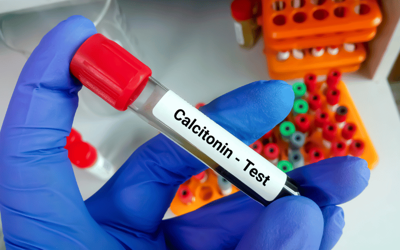 Calcitonin The Unassuming Predictor