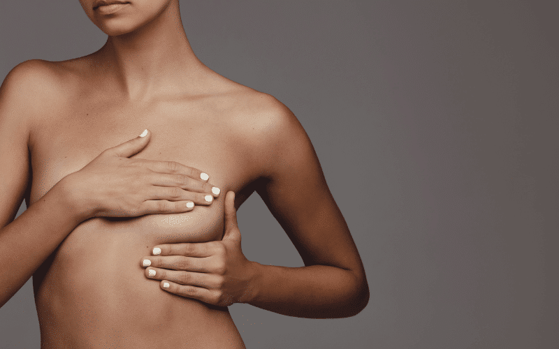 Breast Changes A Potentially Underestimated Sign of Cowden Syndrome