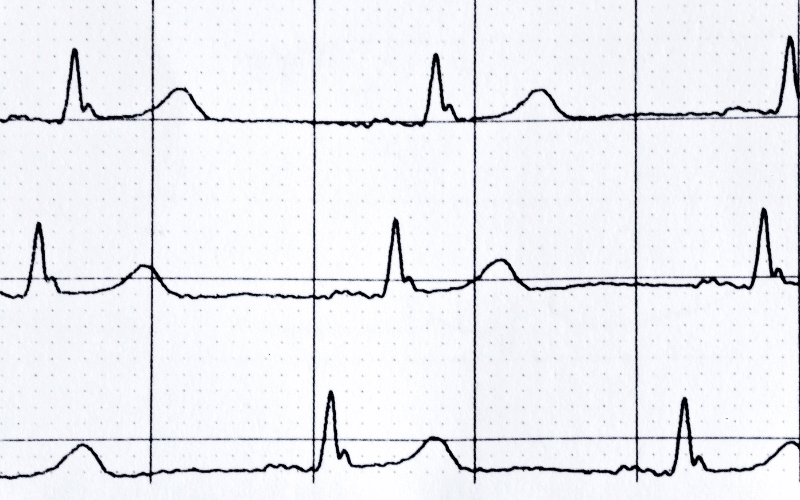 Changes in Heart Rate