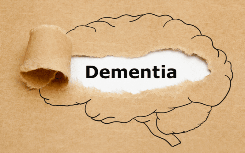 FAQs About Vascular Dementia