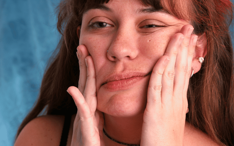 Facial Weakness - The Misinterpreted Symptom of Myopathies