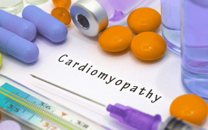 Frequently Asked Questions About Cardiomyopathy