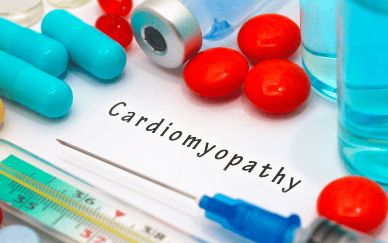 Frequently Asked Questions About Cardiomyopathy