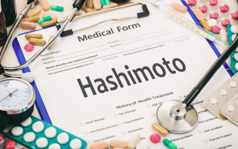 Frequently Asked Questions about Hashimoto's Disease Diet