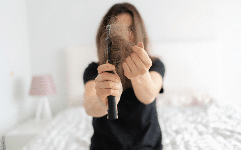 Hair Loss Beyond Normal Postpartum Shedding